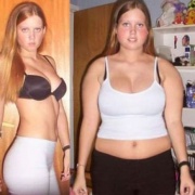 Разительная перемена внешности девушки после лечебного голодания