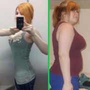 Вот еще пример перемен во внешности после лечебного голодания