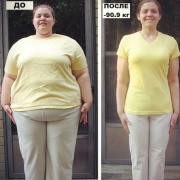 Яркий пример, как гармонично уходит вес на лечебном голодании