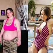 Животик этой девушки оставил лишь воспоминания на фото, после серии дозированных лечебных голоданий